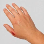 Blodstoppspray 60 ml – Snabbt blodstopp för sår - Bild 2